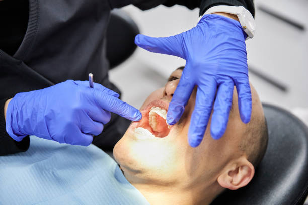 Best Emergency Wisdom Teeth Removal in Broad Brook, CT