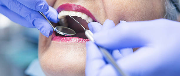 Best Emergency Dental Care for Broken or Chipped Teeth in Broad Brook, CT